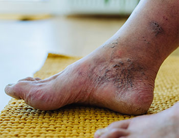The Vascular Center