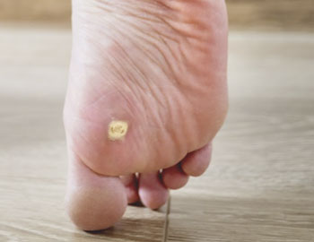 The Wart Center