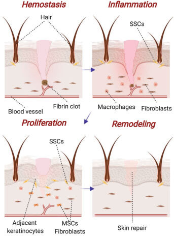 skin substitutiones