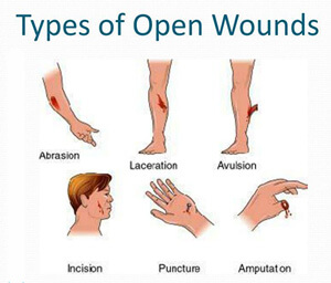 Frontiers | Latest Advances on Bacterial Cellulose-Based Antibacterial  Materials as Wound Dressings