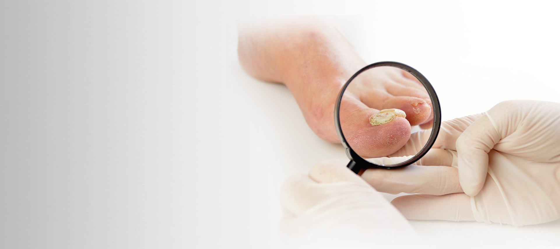 Advanced technology in SWIFT Wart Removal, MLS Laser Treatment and 3D Custom Orthotics