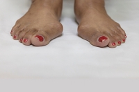 Reasons Why Bunions May Develop