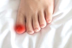 Ingrown Toenails Are More Than Just a Painful Toe