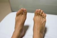 Symptoms Associated With a Bunion