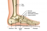 Common Foot Bone Injuries