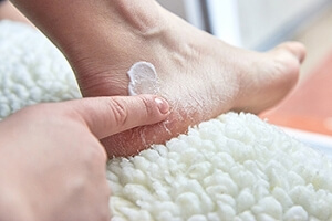 Relief for Cracked Heels
